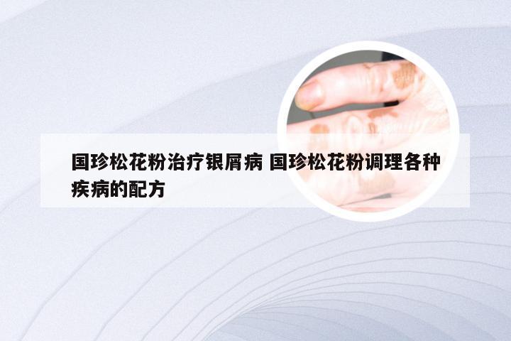 国珍松花粉治疗银屑病 国珍松花粉调理各种疾病的配方