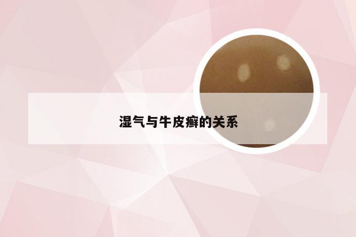 湿气与牛皮癣的关系