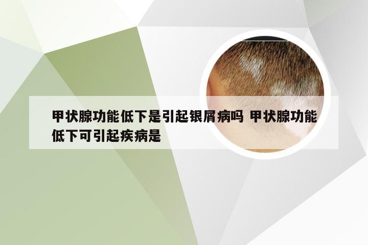 甲状腺功能低下是引起银屑病吗 甲状腺功能低下可引起疾病是