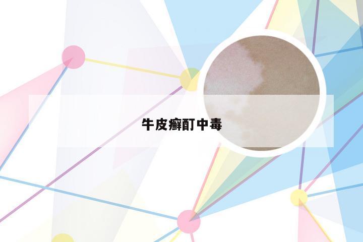 牛皮癣酊中毒