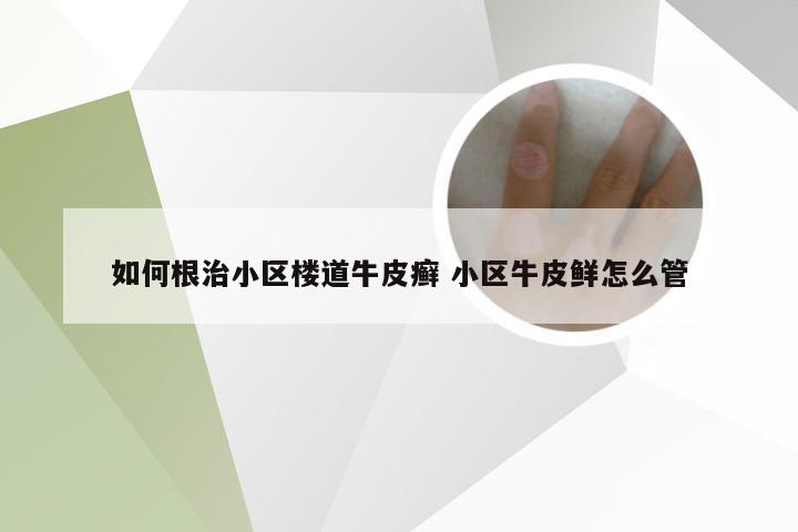 如何根治小区楼道牛皮癣 小区牛皮鲜怎么管