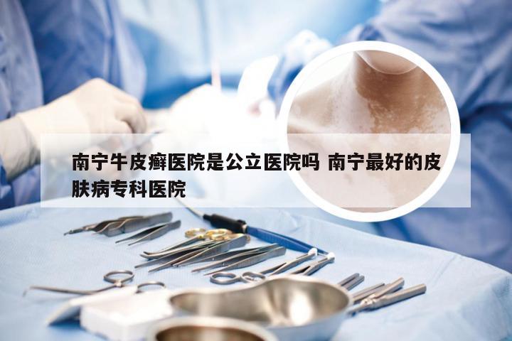 南宁牛皮癣医院是公立医院吗 南宁最好的皮肤病专科医院