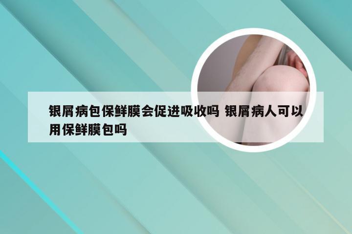 银屑病包保鲜膜会促进吸收吗 银屑病人可以用保鲜膜包吗
