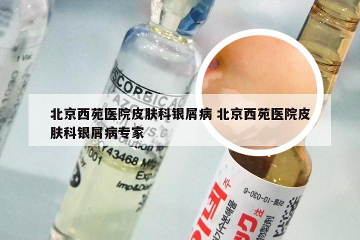 北京西苑医院皮肤科银屑病 北京西苑医院皮肤科银屑病专家