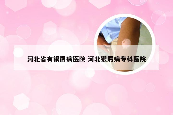 河北省有银屑病医院 河北银屑病专科医院