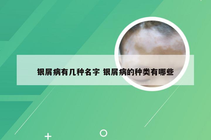 银屑病有几种名字 银屑病的种类有哪些
