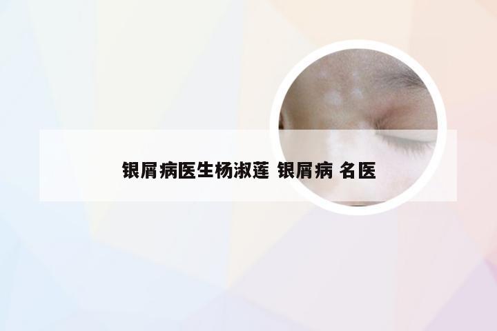 银屑病医生杨淑莲 银屑病 名医