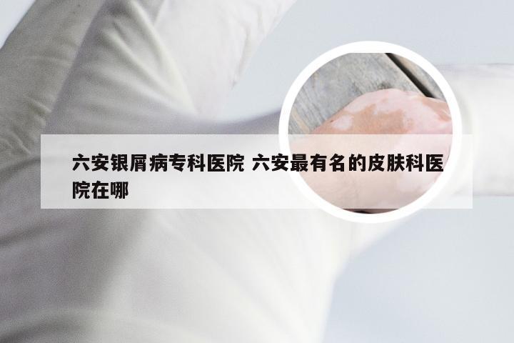 六安银屑病专科医院 六安最有名的皮肤科医院在哪