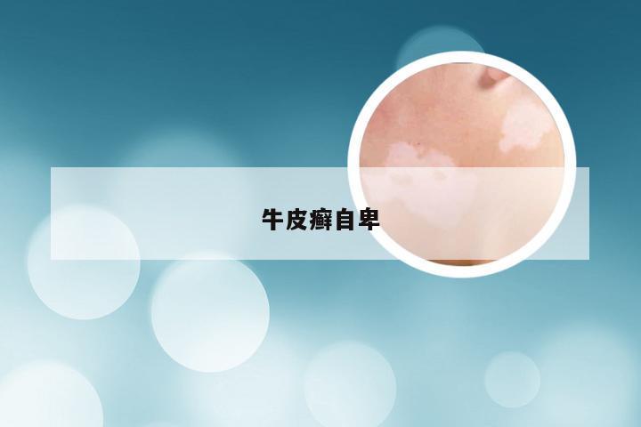 牛皮癣自卑