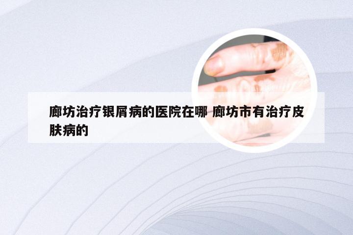 廊坊治疗银屑病的医院在哪 廊坊市有治疗皮肤病的