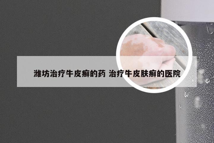 潍坊治疗牛皮癣的药 治疗牛皮肤癣的医院