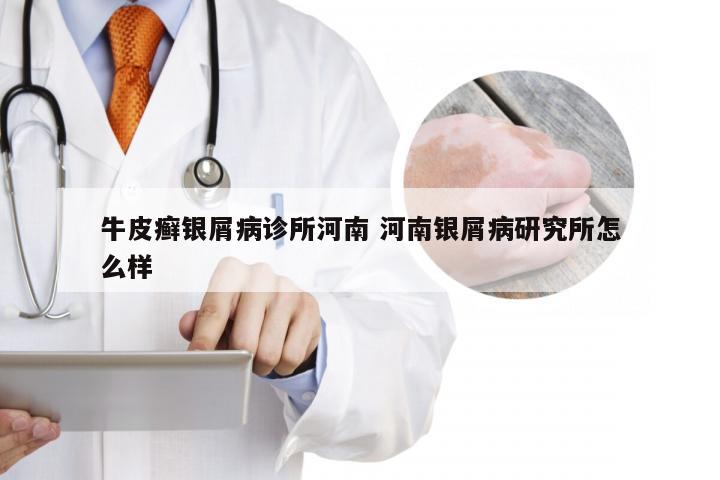 牛皮癣银屑病诊所河南 河南银屑病研究所怎么样