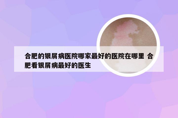 合肥的银屑病医院哪家最好的医院在哪里 合肥看银屑病最好的医生