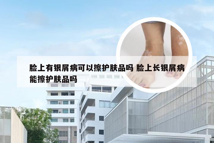 脸上有银屑病可以擦护肤品吗 脸上长银屑病能擦护肤品吗