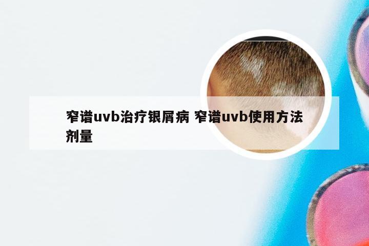 窄谱uvb治疗银屑病 窄谱uvb使用方法剂量