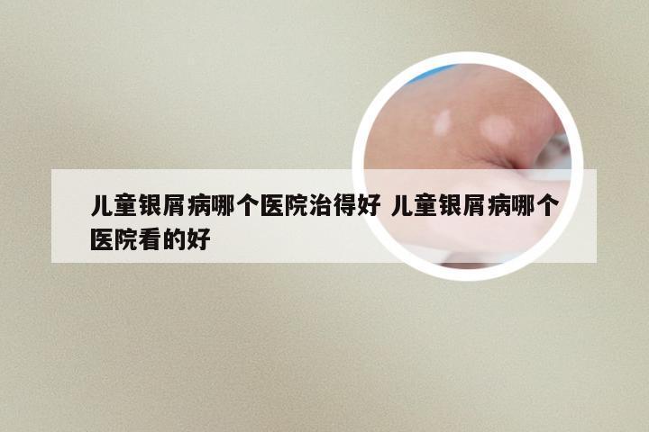 儿童银屑病哪个医院治得好 儿童银屑病哪个医院看的好
