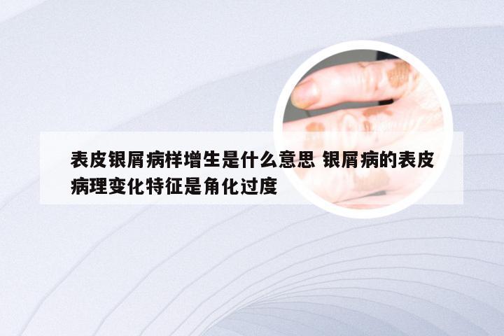 表皮银屑病样增生是什么意思 银屑病的表皮病理变化特征是角化过度