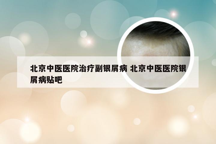 北京中医医院治疗副银屑病 北京中医医院银屑病贴吧