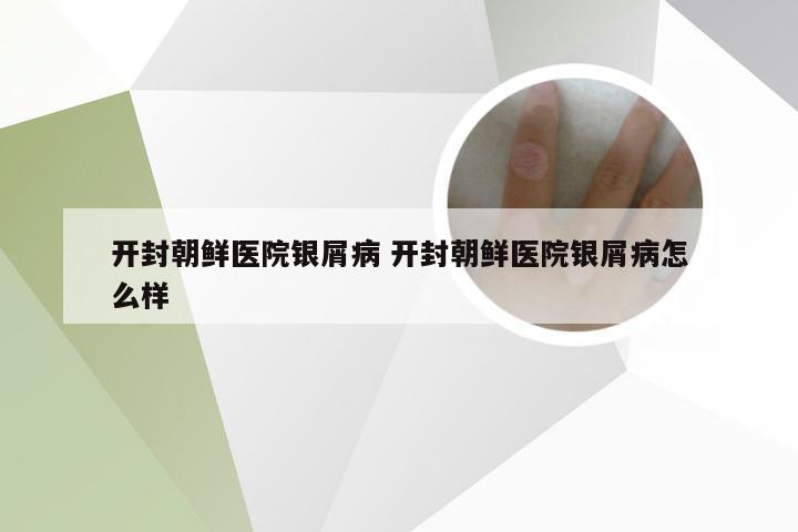 开封朝鲜医院银屑病 开封朝鲜医院银屑病怎么样