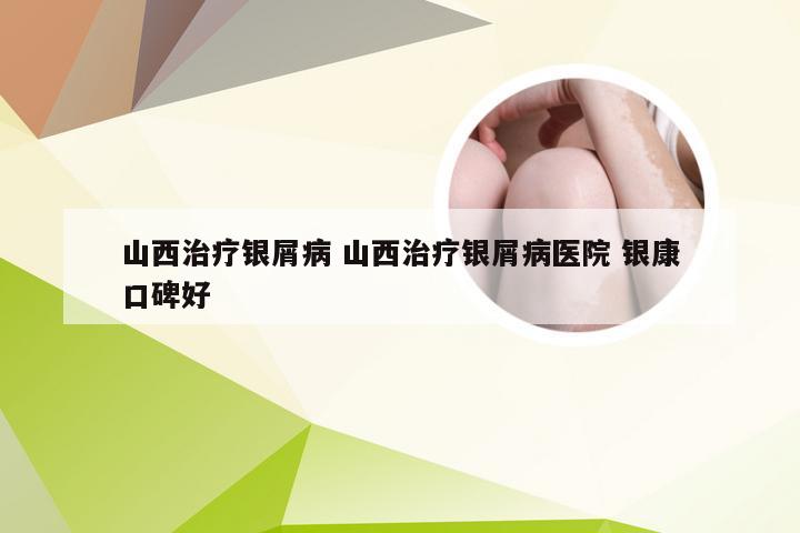 山西治疗银屑病 山西治疗银屑病医院 银康口碑好