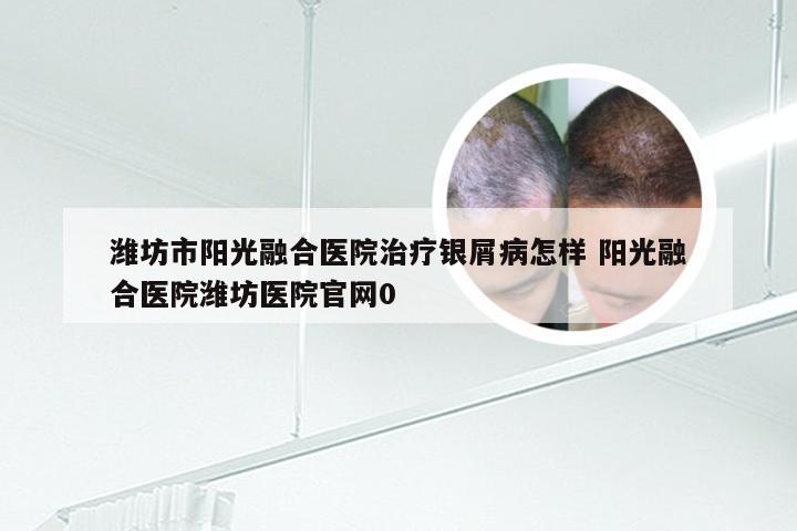潍坊市阳光融合医院治疗银屑病怎样 阳光融合医院潍坊医院官网0