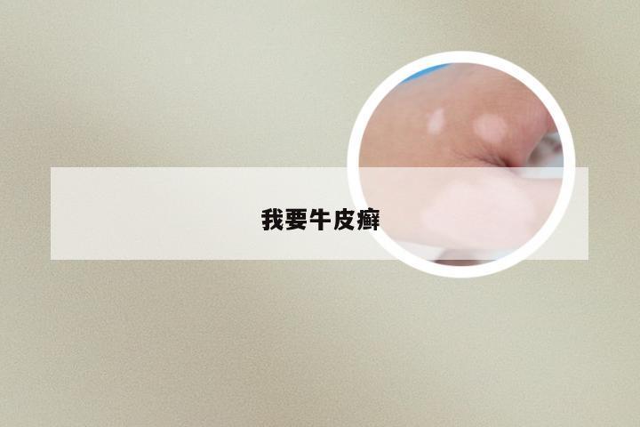 我要牛皮癣