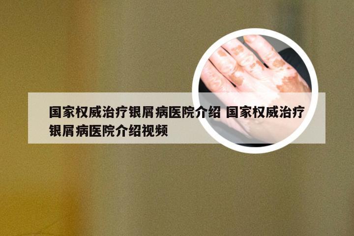 国家权威治疗银屑病医院介绍 国家权威治疗银屑病医院介绍视频