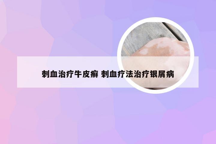 刺血治疗牛皮癣 刺血疗法治疗银屑病