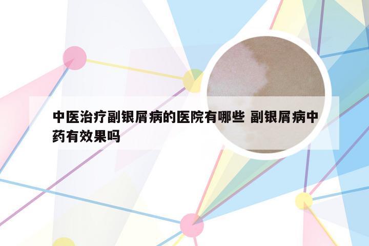 中医治疗副银屑病的医院有哪些 副银屑病中药有效果吗