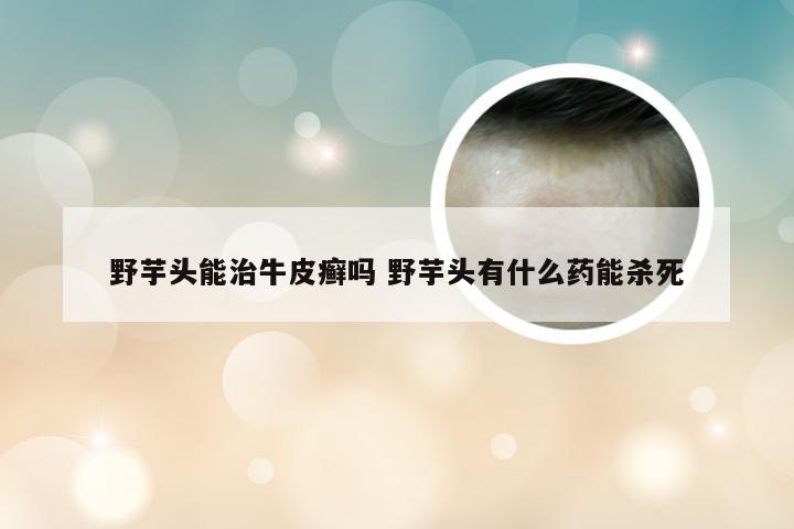 野芋头能治牛皮癣吗 野芋头有什么药能杀死