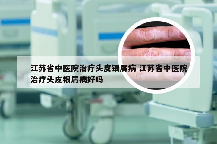 江苏省中医院治疗头皮银屑病 江苏省中医院治疗头皮银屑病好吗