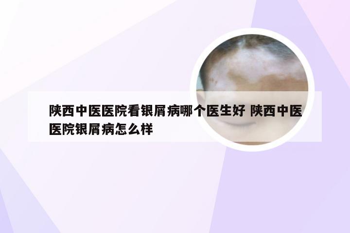 陕西中医医院看银屑病哪个医生好 陕西中医医院银屑病怎么样