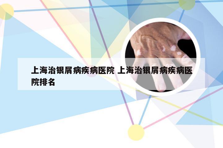 上海治银屑病疾病医院 上海治银屑病疾病医院排名