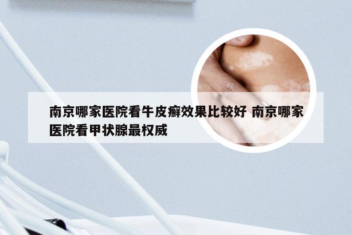 南京哪家医院看牛皮癣效果比较好 南京哪家医院看甲状腺最权威