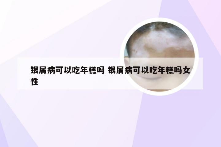 银屑病可以吃年糕吗 银屑病可以吃年糕吗女性