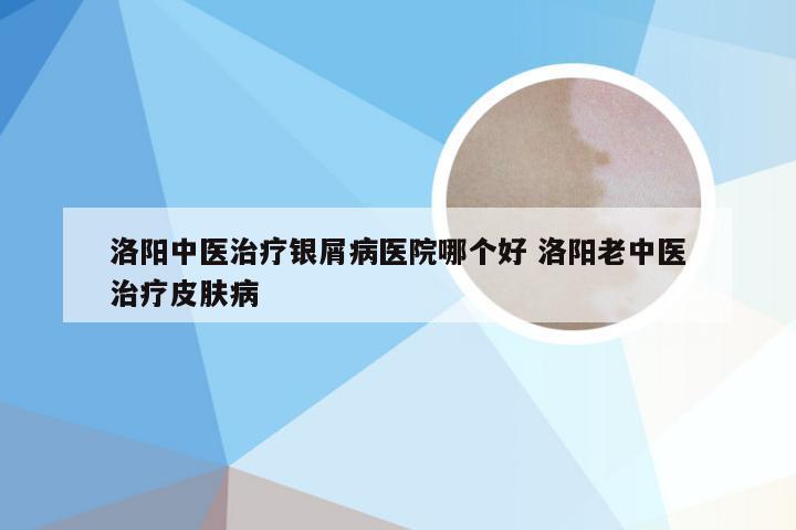 洛阳中医治疗银屑病医院哪个好 洛阳老中医治疗皮肤病
