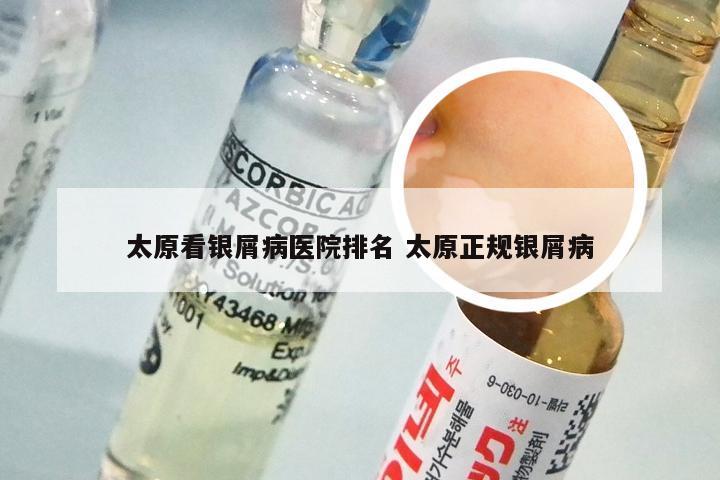 太原看银屑病医院排名 太原正规银屑病