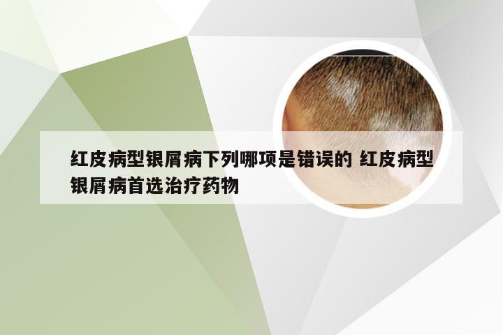 红皮病型银屑病下列哪项是错误的 红皮病型银屑病首选治疗药物
