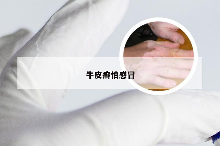 牛皮癣怕感冒