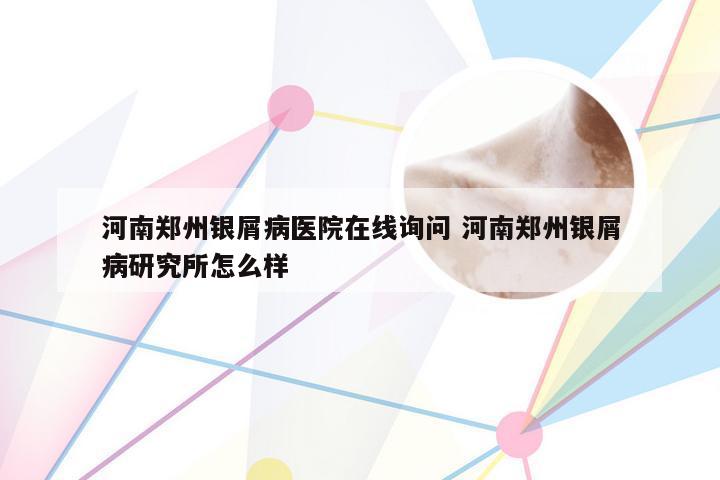 河南郑州银屑病医院在线询问 河南郑州银屑病研究所怎么样