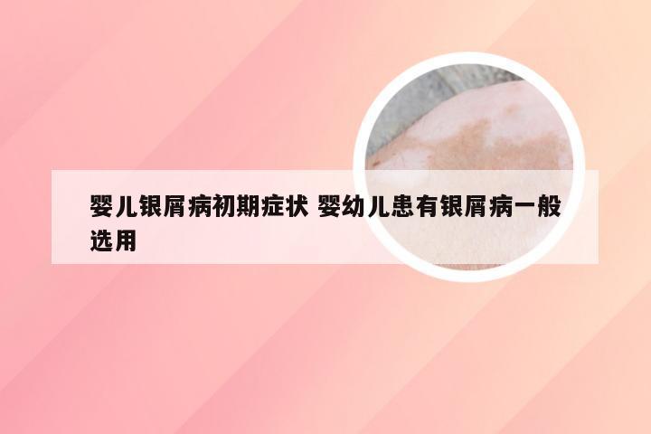 婴儿银屑病初期症状 婴幼儿患有银屑病一般选用