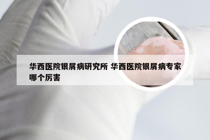 华西医院银屑病研究所 华西医院银屑病专家哪个厉害