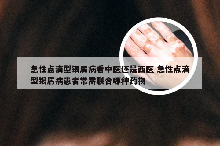 急性点滴型银屑病看中医还是西医 急性点滴型银屑病患者常需联合哪种药物