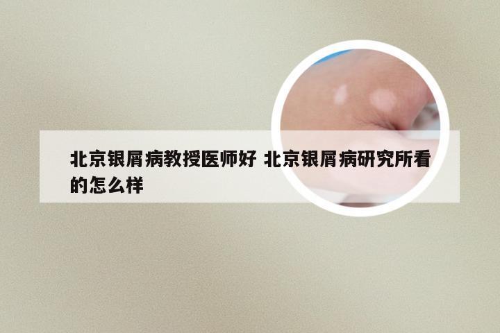 北京银屑病教授医师好 北京银屑病研究所看的怎么样