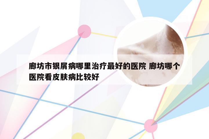 廊坊市银屑病哪里治疗最好的医院 廊坊哪个医院看皮肤病比较好