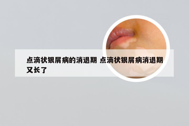 点滴状银屑病的消退期 点滴状银屑病消退期又长了