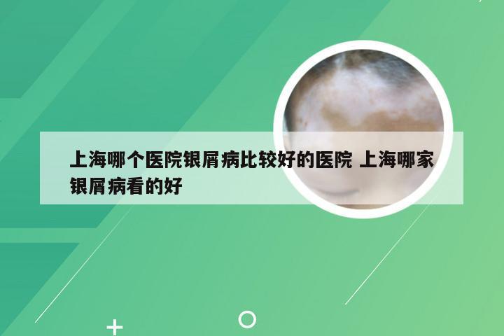 上海哪个医院银屑病比较好的医院 上海哪家银屑病看的好