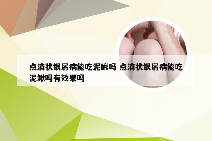 点滴状银屑病能吃泥鳅吗 点滴状银屑病能吃泥鳅吗有效果吗