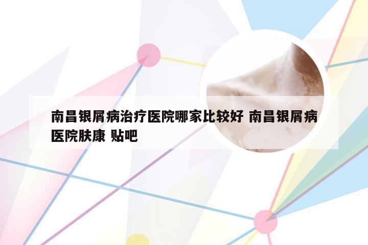 南昌银屑病治疗医院哪家比较好 南昌银屑病医院肤康 贴吧