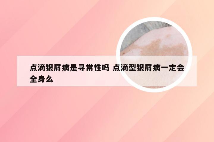 点滴银屑病是寻常性吗 点滴型银屑病一定会全身么
